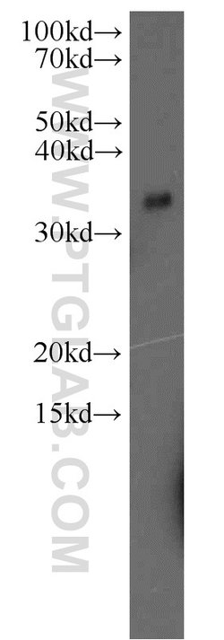 CAPZA2 Rabbit anti-Human, Mouse, Rat, Polyclonal, Proteintech 20 &mu;L;