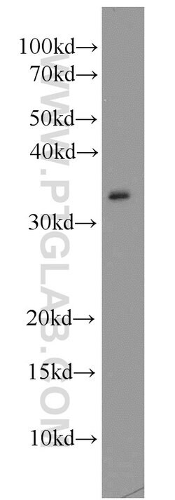 CAPZA2 Rabbit anti-Human, Mouse, Rat, Polyclonal, Proteintech 20 &mu;L;