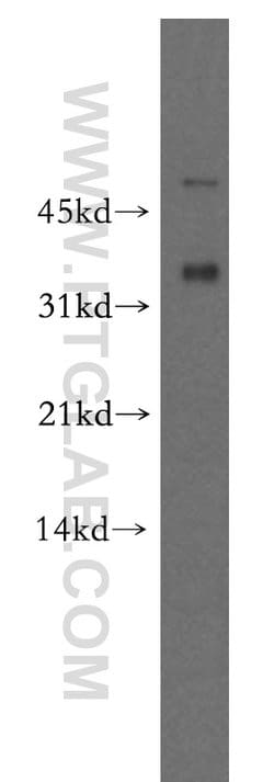 CAPZA2 Rabbit anti-Human, Mouse, Rat, Polyclonal, Proteintech 20 &mu;L;