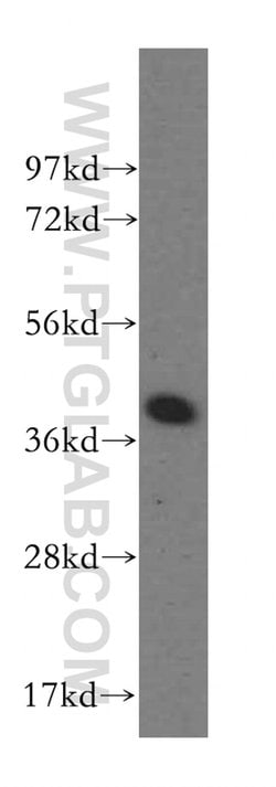 DYNC2LI1 Rabbit anti-Human, Mouse, Rat, Polyclonal, Proteintech:Antibodies:Primary