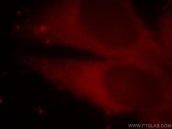 MAT2B Rabbit anti-Human, Mouse, Rat, Polyclonal, Proteintech 150 &mu;L;