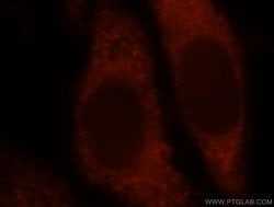 MAT2B Rabbit anti-Human, Mouse, Rat, Polyclonal, Proteintech 150 &mu;L;