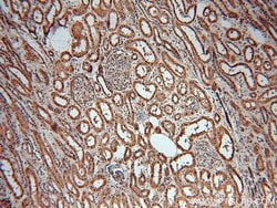 MAT2B Rabbit anti-Human, Mouse, Rat, Polyclonal, Proteintech 150 &mu;L;