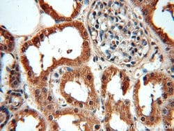 MAT2B Rabbit anti-Human, Mouse, Rat, Polyclonal, Proteintech 150 &mu;L;