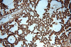 MAT2B Rabbit anti-Human, Mouse, Rat, Polyclonal, Proteintech 150 &mu;L;