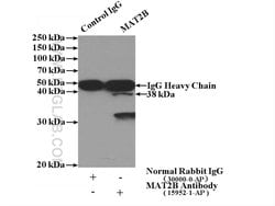 MAT2B Rabbit anti-Human, Mouse, Rat, Polyclonal, Proteintech 150 &mu;L;