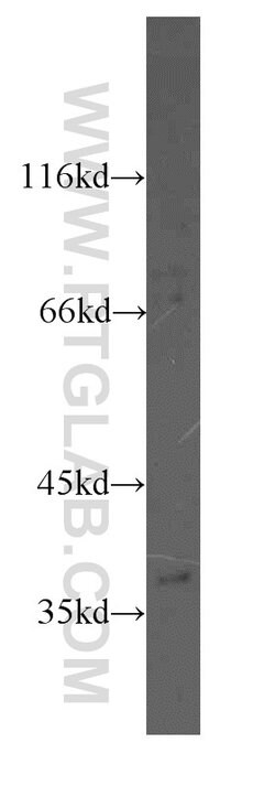 MAT2B Rabbit anti-Human, Mouse, Rat, Polyclonal, Proteintech 150 &mu;L;
