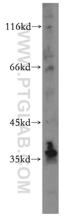 MAT2B Rabbit anti-Human, Mouse, Rat, Polyclonal, Proteintech 150 &mu;L;