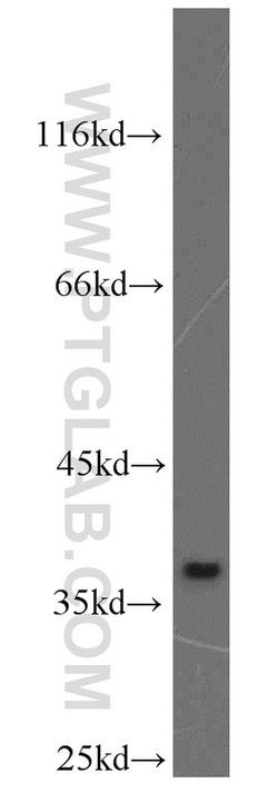 MAT2B Rabbit anti-Human, Mouse, Rat, Polyclonal, Proteintech 150 &mu;L;