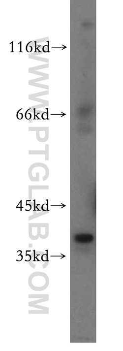 MAT2B Rabbit anti-Human, Mouse, Rat, Polyclonal, Proteintech 150 &mu;L;