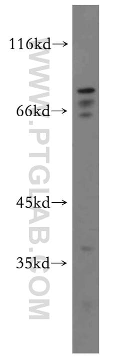 MAT2B Rabbit anti-Human, Mouse, Rat, Polyclonal, Proteintech 150 &mu;L;