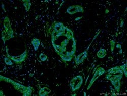 Glucagon Rabbit anti-Human, Mouse, Rat, Polyclonal, Proteintech 150 &mu;L;