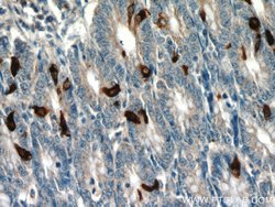 Glucagon Rabbit anti-Human, Mouse, Rat, Polyclonal, Proteintech 150 &mu;L;