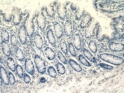Glucagon Rabbit anti-Human, Mouse, Rat, Polyclonal, Proteintech 150 &mu;L;