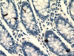 Glucagon Rabbit anti-Human, Mouse, Rat, Polyclonal, Proteintech 150 &mu;L;