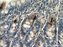 Glucagon Rabbit anti-Human, Mouse, Rat, Polyclonal, Proteintech 150 &mu;L;