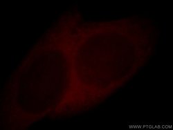 Cystatin A Rabbit anti-Human, Mouse, Polyclonal, Proteintech 150 &mu;L;