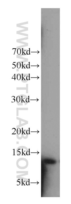 Cystatin A Rabbit anti-Human, Mouse, Polyclonal, Proteintech 150 &mu;L;