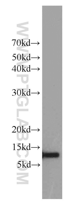 Cystatin A Rabbit anti-Human, Mouse, Polyclonal, Proteintech 150 &mu;L;