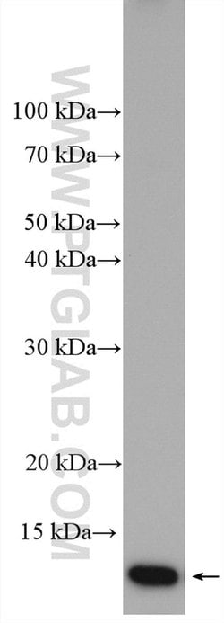 Cystatin A Rabbit anti-Human, Mouse, Polyclonal, Proteintech 150 &mu;L;