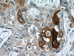Elafin/Skalp Rabbit anti-Human, Polyclonal, Proteintech:Antibodies:Primary
