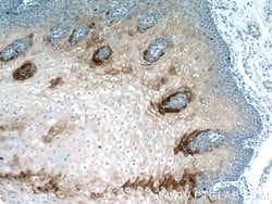 Elafin/Skalp Rabbit anti-Human, Polyclonal, Proteintech:Antibodies:Primary