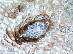 Elafin/Skalp Rabbit anti-Human, Polyclonal, Proteintech:Antibodies:Primary