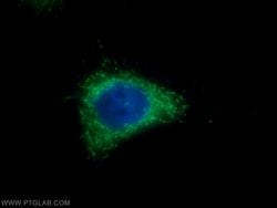 Elafin/Skalp Rabbit anti-Human, Polyclonal, Proteintech:Antibodies:Primary