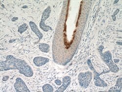 Elafin/Skalp Rabbit anti-Human, Polyclonal, Proteintech:Antibodies:Primary