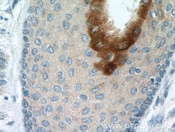 Elafin/Skalp Rabbit anti-Human, Polyclonal, Proteintech:Antibodies:Primary
