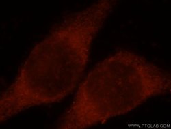 CLIC3 Rabbit anti-Human, Mouse, Rat, Polyclonal, Proteintech:Antibodies:Primary