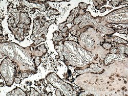CLIC3 Rabbit anti-Human, Mouse, Rat, Polyclonal, Proteintech:Antibodies:Primary