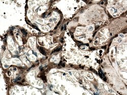 CLIC3 Rabbit anti-Human, Mouse, Rat, Polyclonal, Proteintech:Antibodies:Primary