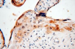 CLIC3 Rabbit anti-Human, Mouse, Rat, Polyclonal, Proteintech:Antibodies:Primary