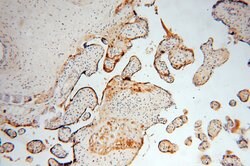 CLIC3 Rabbit anti-Human, Mouse, Rat, Polyclonal, Proteintech:Antibodies:Primary