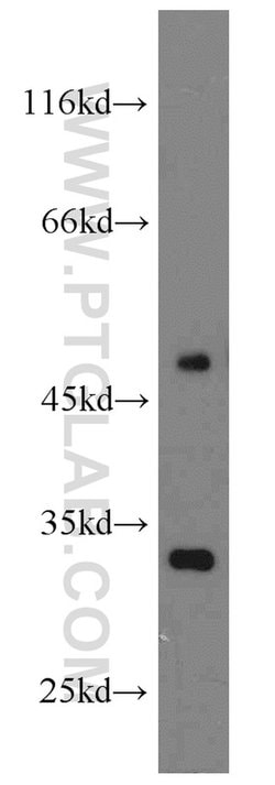 CLIC3 Rabbit anti-Human, Mouse, Rat, Polyclonal, Proteintech:Antibodies:Primary