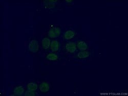 PSMB10 Rabbit anti-Human, Mouse, Rat, Polyclonal, Proteintech:Antibodies:Primary