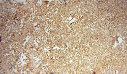 PSMB10 Rabbit anti-Human, Mouse, Rat, Polyclonal, Proteintech:Antibodies:Primary