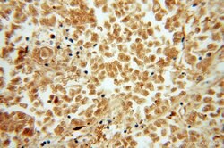 PSMB10 Rabbit anti-Human, Mouse, Rat, Polyclonal, Proteintech:Antibodies:Primary