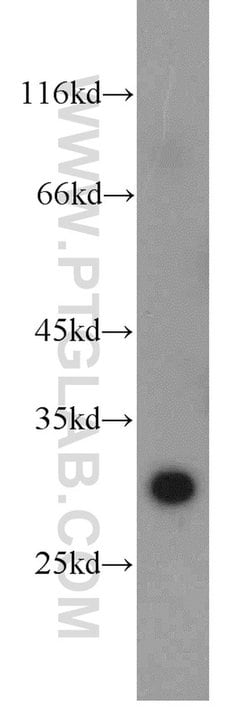 PSMB10 Rabbit anti-Human, Mouse, Rat, Polyclonal, Proteintech:Antibodies:Primary