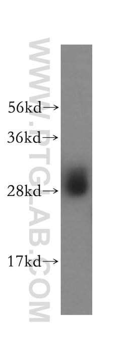 PSMB10 Rabbit anti-Human, Mouse, Rat, Polyclonal, Proteintech:Antibodies:Primary