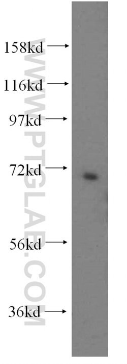 PAPSS2 Rabbit anti-Human, Mouse, Rat, Polyclonal, Proteintech 150 &mu;L | Buy Online | Proteintech Group Inc | Fisher Scientific