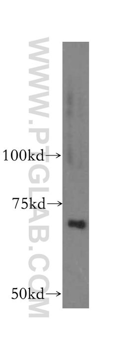 PAPSS2 Rabbit anti-Human, Mouse, Rat, Polyclonal, Proteintech 150 &mu;L | Buy Online | Proteintech Group Inc | Fisher Scientific