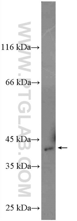 Spermine synthase Rabbit anti-Human, Mouse, Rat, Polyclonal, Proteintech:Anticorps:Anticorps