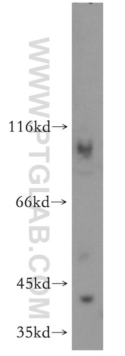Proteintech Spermine synthase Rabbit anti-Human, Mouse, Rat, Polyclonal, Proteintech