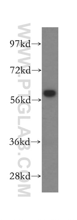 CCT7 Rabbit anti-Human, Mouse, Rat, Polyclonal, Proteintech:  