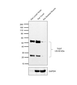 TIGIT Monoclonal Antibody (GIGD7), Functional Grade, eBioscience:Antibodies,