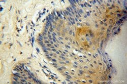 FGL1 Rabbit anti-Human, Mouse, Rat, Polyclonal, Proteintech 150 &mu;L;