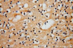 FGL1 Rabbit anti-Human, Mouse, Rat, Polyclonal, Proteintech 150 &mu;L;