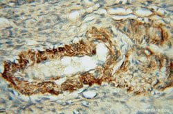 FGL1 Rabbit anti-Human, Mouse, Rat, Polyclonal, Proteintech 150 &mu;L;